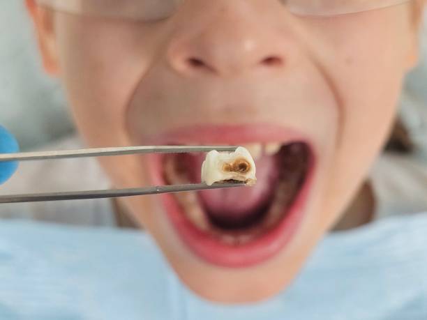 Best Walk-In Emergency Dentist in Melissa, TX